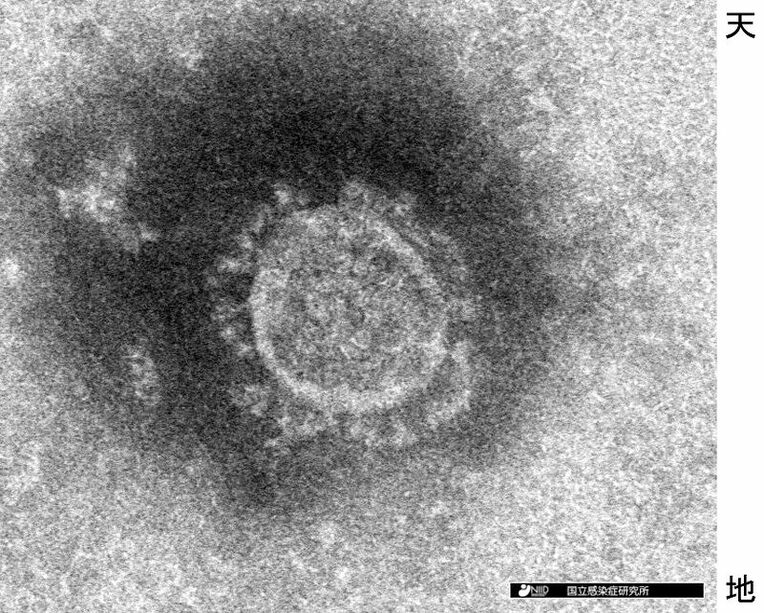 新型コロナウイルスの電子顕微鏡写真（国立感染症研究所提供）