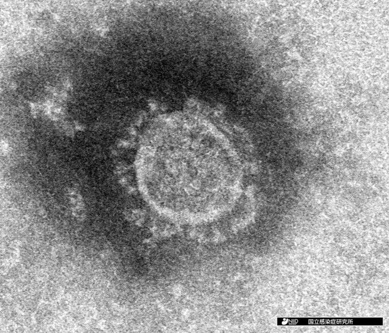 （資料写真）新型コロナウイルスの電子顕微鏡写真（国立感染症研究所提供）
