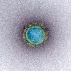 （資料写真）新型コロナウイルスの電子顕微鏡写真（米国立アレルギー感染症研究所提供）