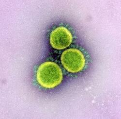 　新型コロナウイルスの電子顕微鏡写真（米国立アレルギー感染症研究所提供）