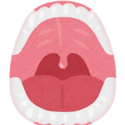 口の中のがん年々増加 半数は舌がん 長引く口内炎など異変に注意