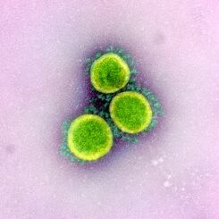 （資料写真）新型コロナウイルスの電子顕微鏡写真（米国立アレルギー感染症研究所提供）											