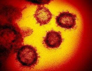 （資料写真）新型コロナウイルスの電子顕微鏡写真（米国立アレルギー感染症研究所提供）