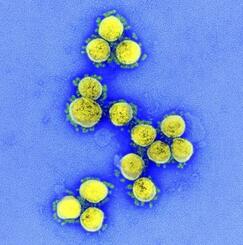 　電子顕微鏡で見た新型コロナウイルスの写真（アメリカ国立アレルギー感染症研究所提供）